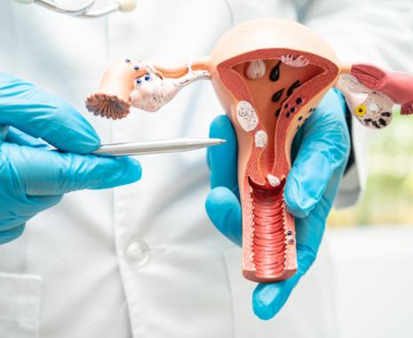 January 2024 – Cervical Cancer Screening Workshop