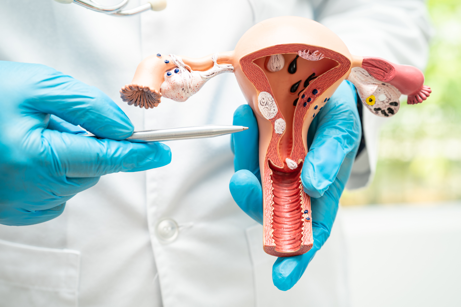 January 2024 – Cervical Cancer Screening Workshop